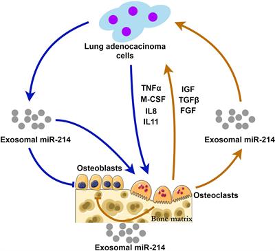 The Potential Roles of Exosomal miR-214 in Bone Metastasis of Lung Adenocarcinoma